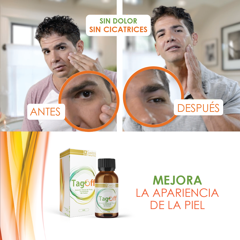 Tag Off Solución Verrugas y Carnosidades